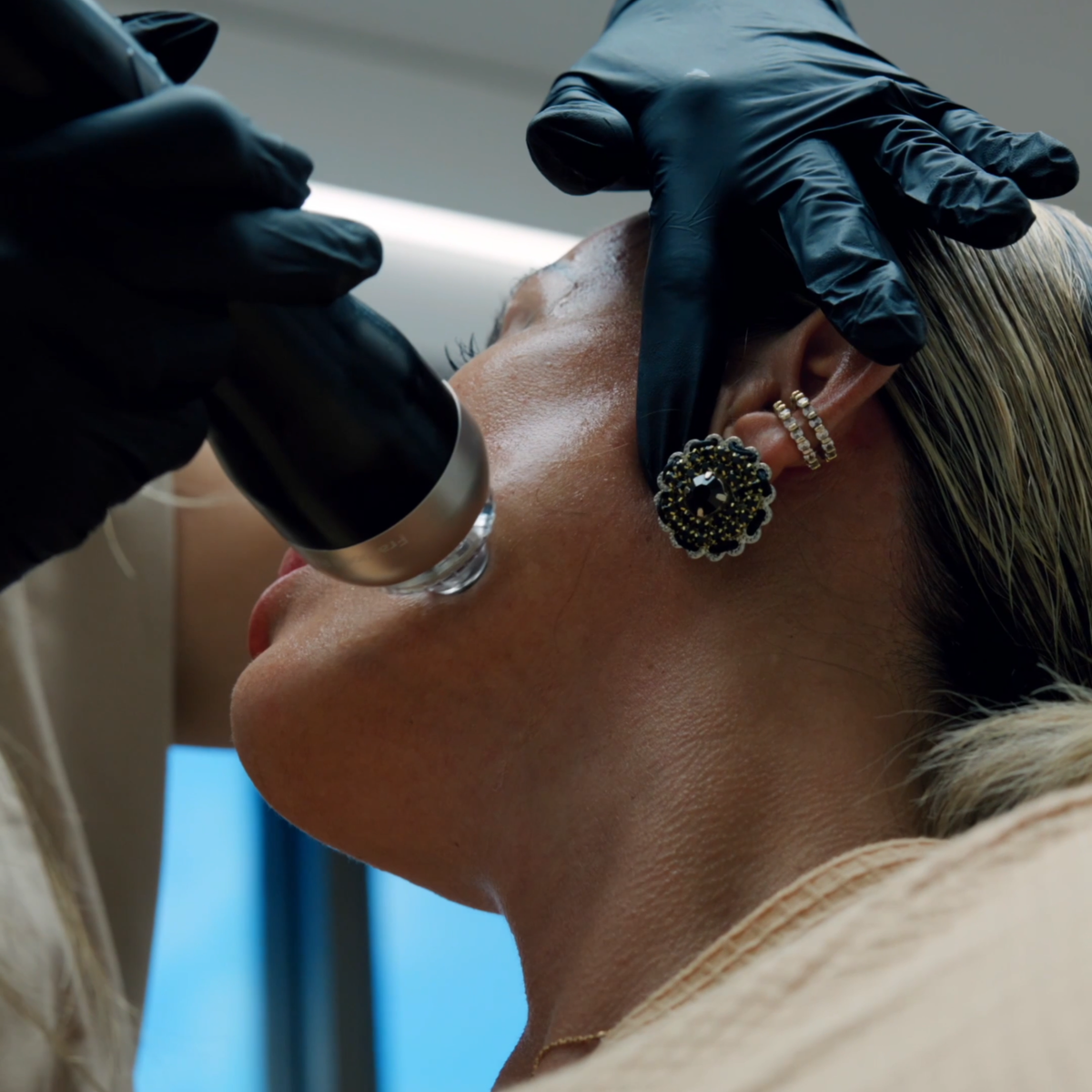 SKIN REJUVENATION