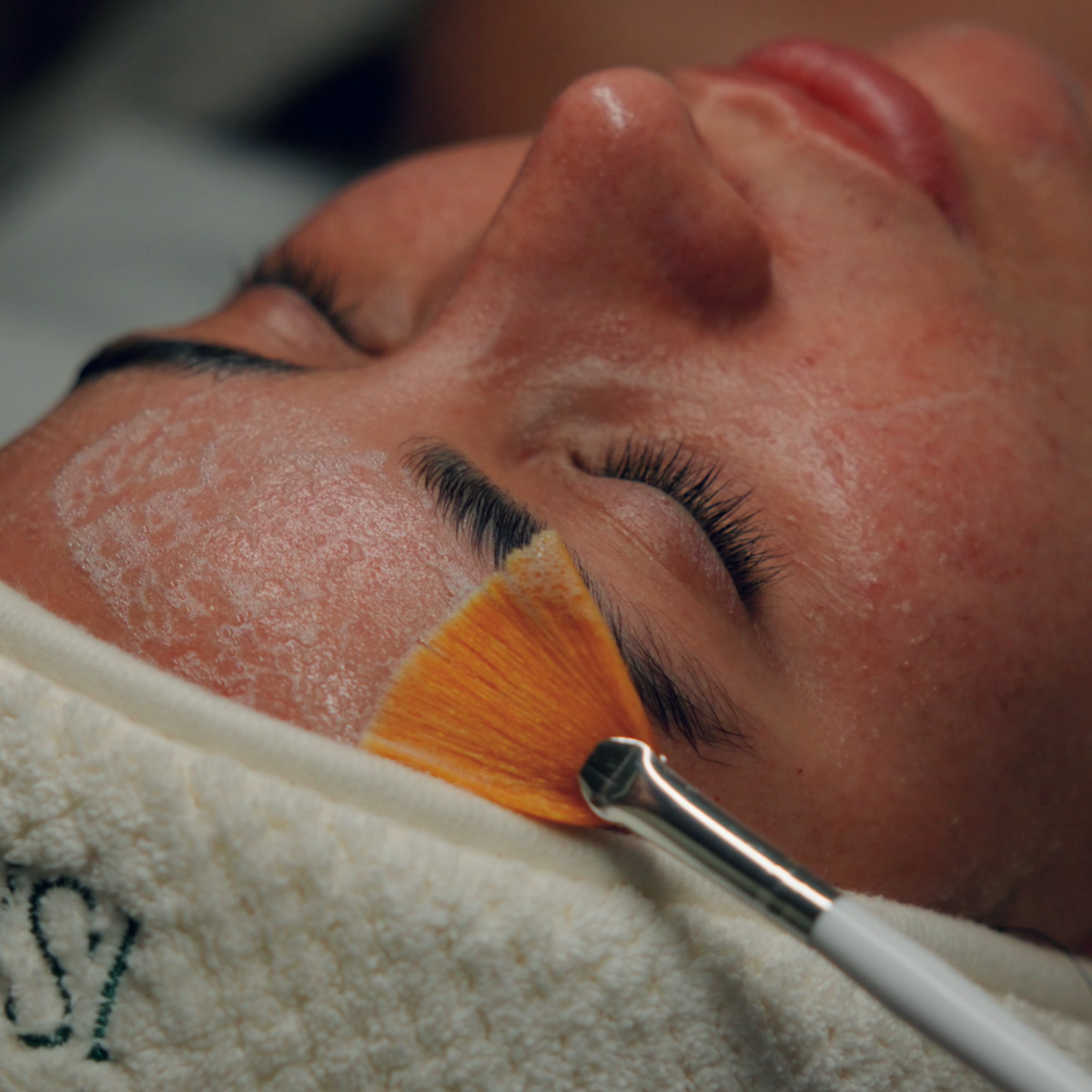 MEDICAL FACIALS